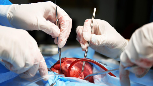 Norwegia: śmierć krążeniowa pozwoli na pobranie organów. Koniec kilkuletniego sporu
